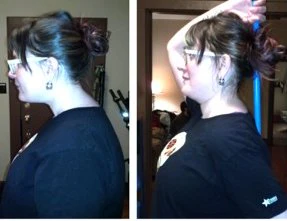 Karen Before Kettlebells: (Left – “ Normal” Posture & Right “Correcting” posture with a broom handle) February 2014